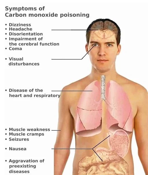 Symptoms of Carbon Monoxide Poisoning 